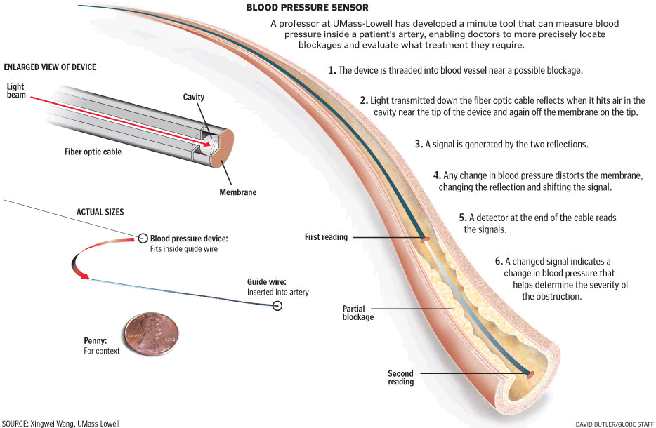 Blood pressure sensor