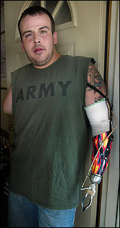 National Guard Sergeant Peter J. Damon lost both his arms in a helicopter repair accident.