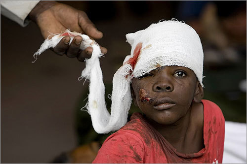 A Haitian boy received treatment at an ad hoc medical clinic at the United Nations logistics base.