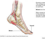 How running the marathon affects the body