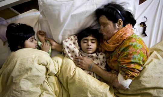 Pakistani acid attack victim Naziran Abid, 23, puts her daughters Haseena Abid, 5, and Alishba 3, to sleep at the Acid Survivors Foundation in Islamabad. Acid was thrown on Naziran’s face and torso by an unknown attacker while sleeping.