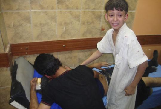 Boys gathered around their  brother, who was wounded in one of seven bombings in Baghdad yesterday.